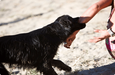 dog biting person's arm - dog bite lawyer