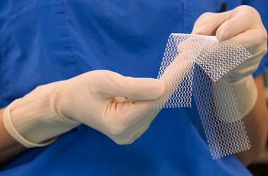 transvaginal mesh