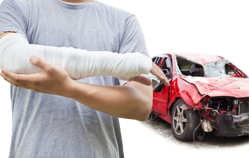 man in arm cast after car accident