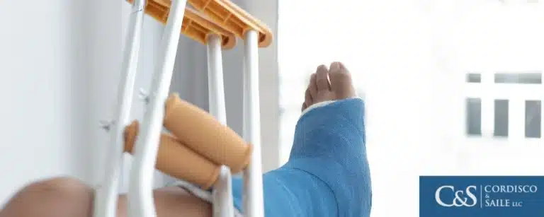 Person in leg cast