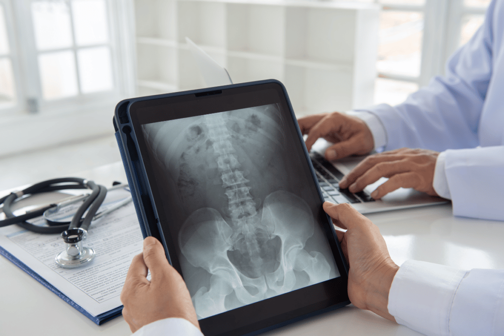 X-ray of spinal cord injury