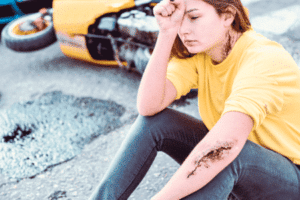 Common motorcycle injuries