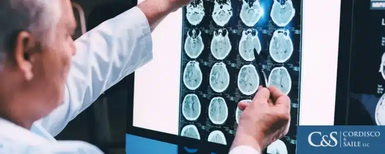 person-looking-at-concussion-injury-scans