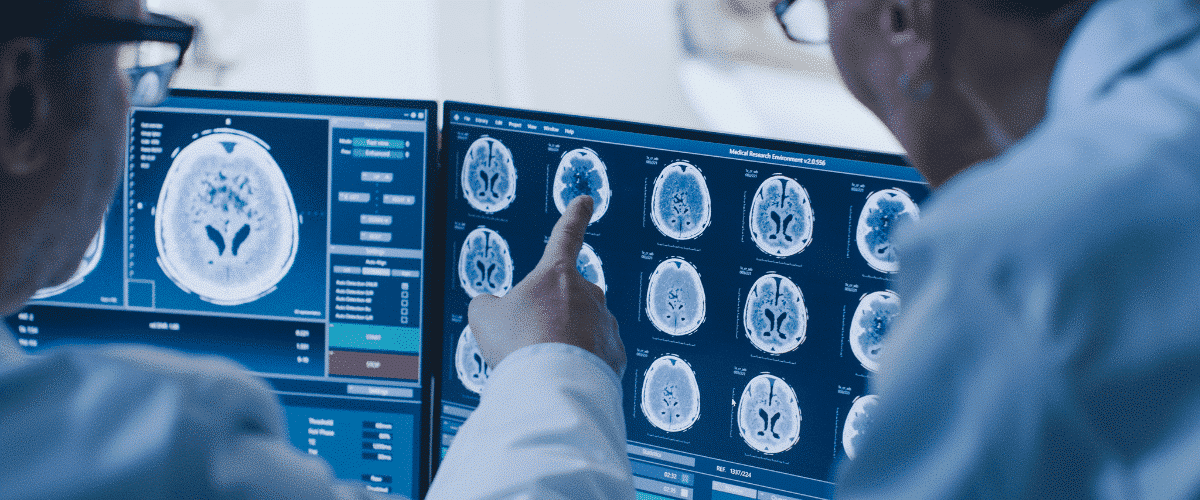 doctors looking at brain scans