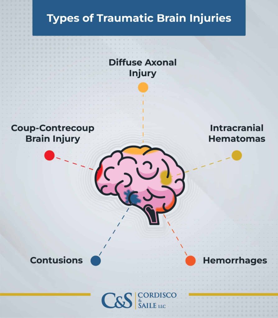 types of traumatic brain injuries infographic