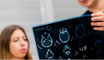 people examining brain injury scans