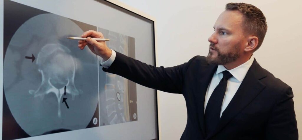 Image of Attorney Michael looking at an xray